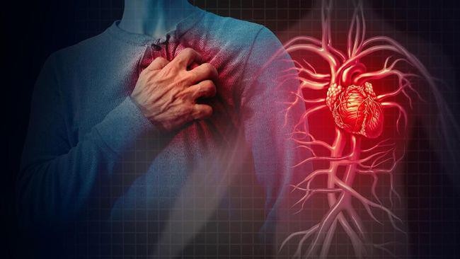 Ilustrasi serangan jantung akibat tersumbat pembuluh darah pada usia muda